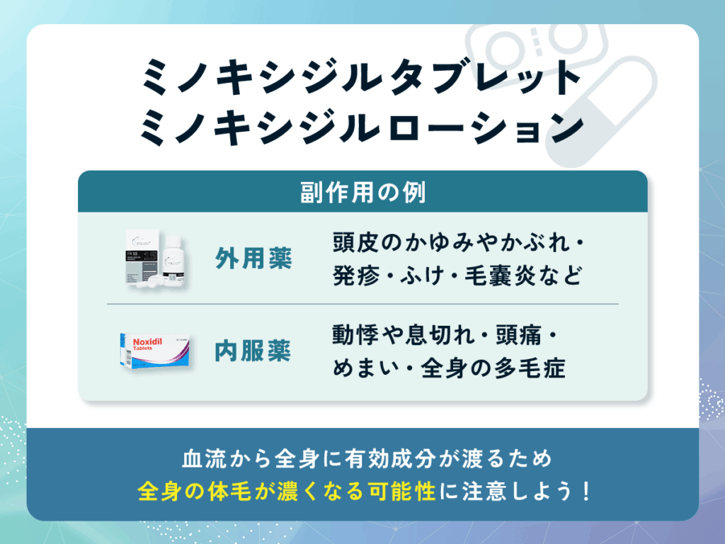 はげ薬の副作用とやめるリスク③：ミノキシジルタブレット・ミノキシジルローション