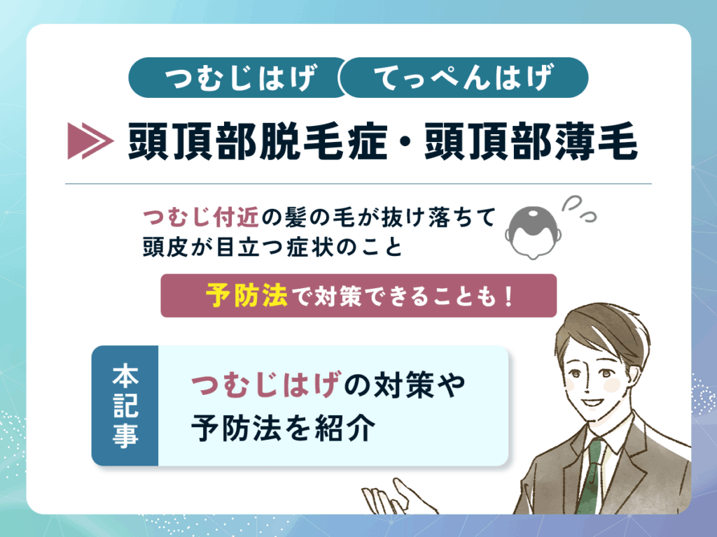 つむじはげ・てっぺんはげ